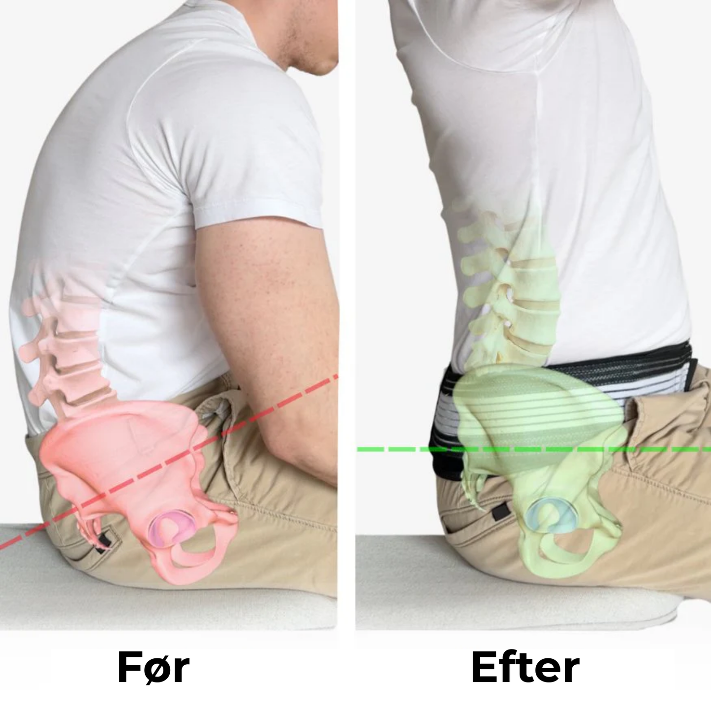 OrthoBelt | Genvind din ryg, genvind dit liv