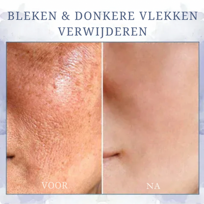 Firméa™ | Opstrammende og rynkereducerende creme