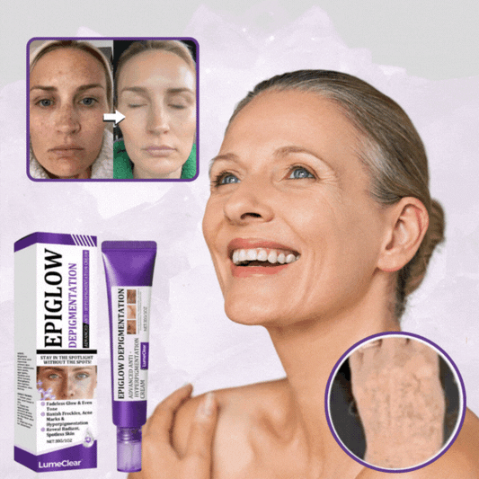 DermaLume™ Korrektion af pigmentpletter | Op til 95 % færre mørke pletter på kun 7 dage!