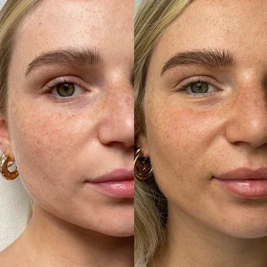 <h2><strong>Tro ikke bare på os, se hvad andre siger!</strong></h2>