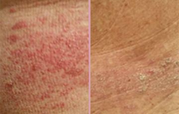 <h2><strong>Tro ikke bare på os, se hvad andre siger!</strong></h2>