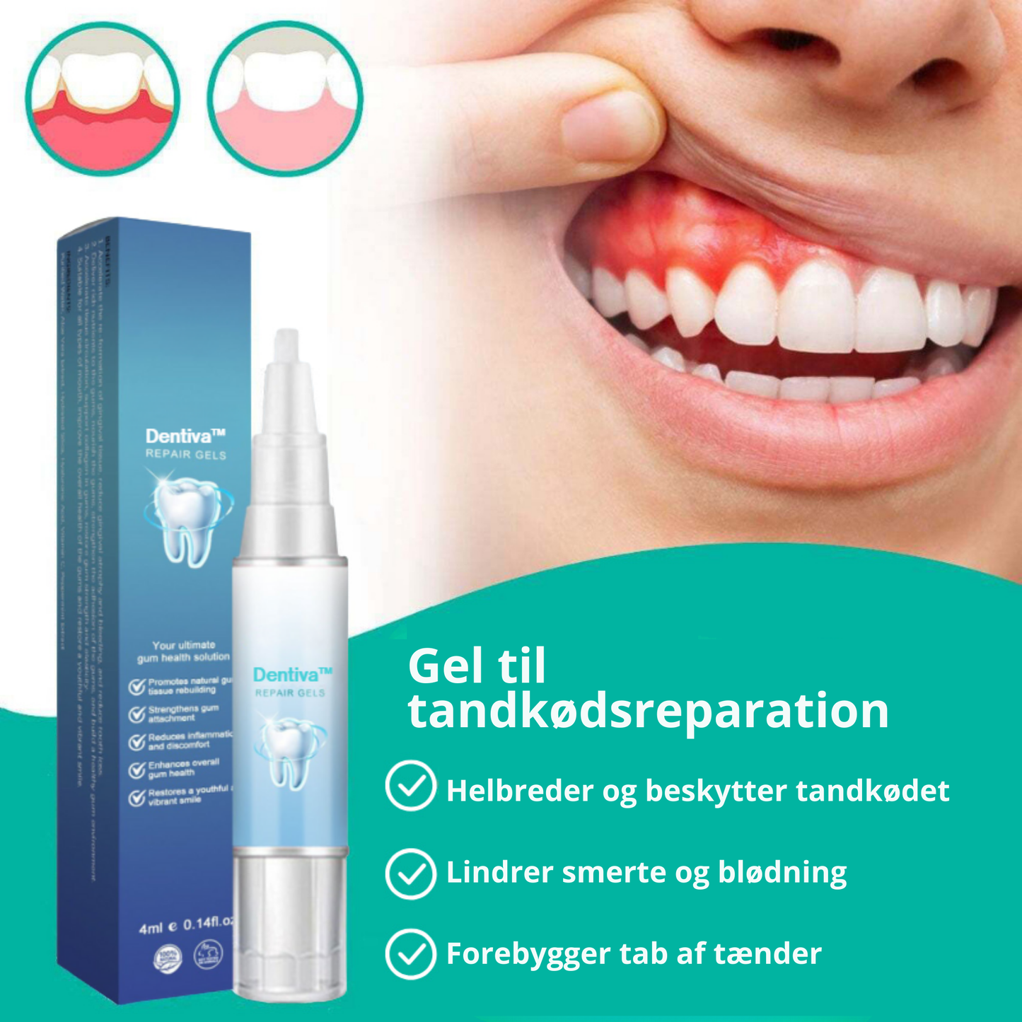 Dentiva™ | Helbred og beskyt dit tandkød