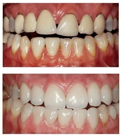 <h2><strong>Tro ikke bare på os, se hvad andre siger!</strong></h2>