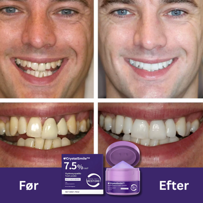 CrystalSmile™ | Få Dit Klareste Smil – Uden Smerter, Uden Peroxid!