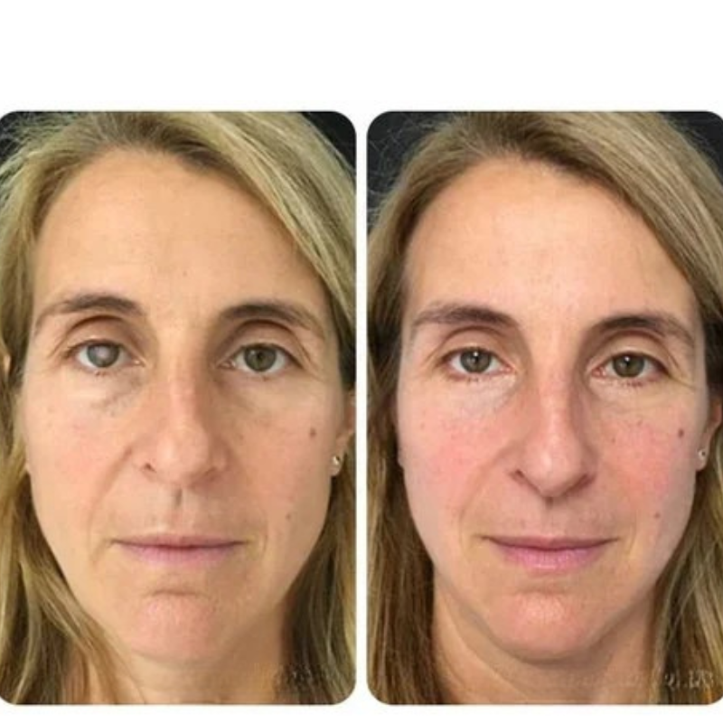 <h2><strong>Tro ikke bare på os, se hvad andre siger!</strong></h2>