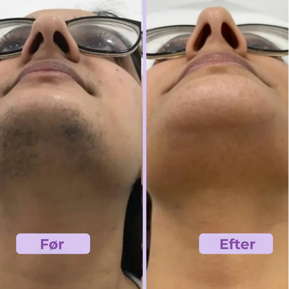 Silkea | Klar til en fejlfri, strålende ansigt