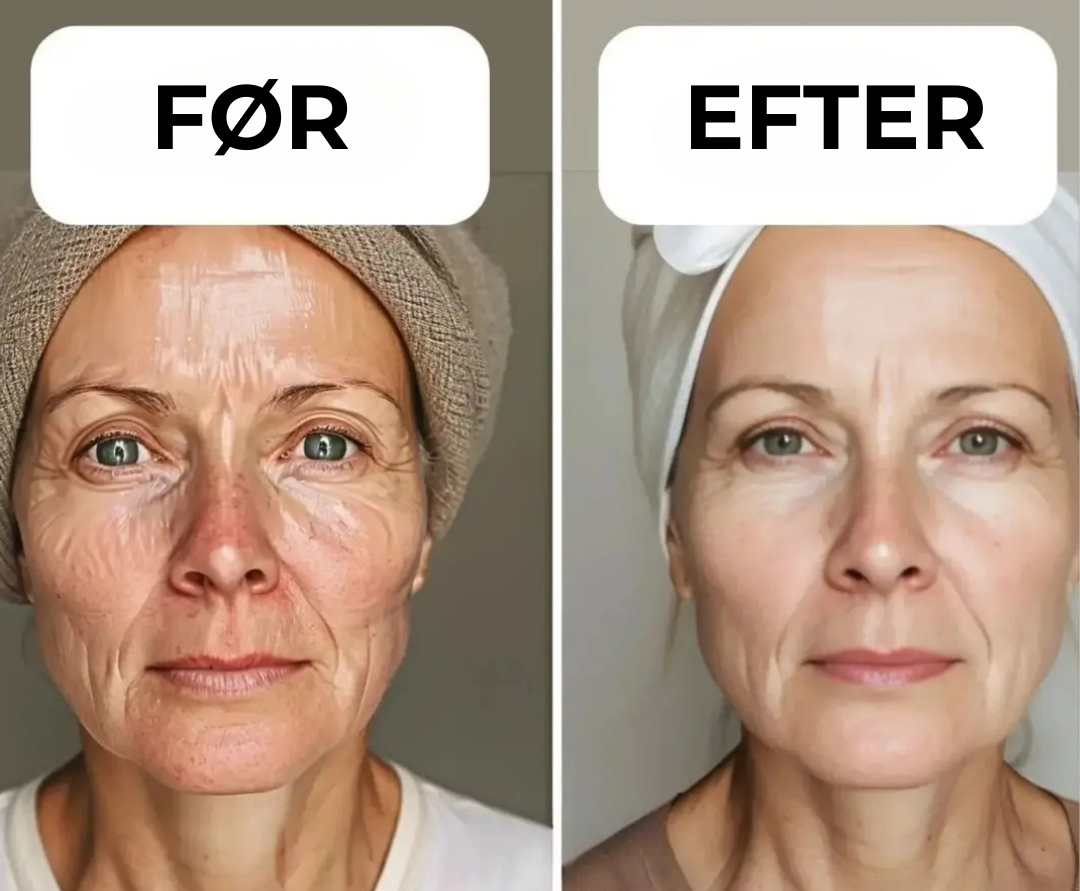 GreenDame™ | Hemmeligheden bag ungdommelig, strålende hud – uden skrappe kemikalier