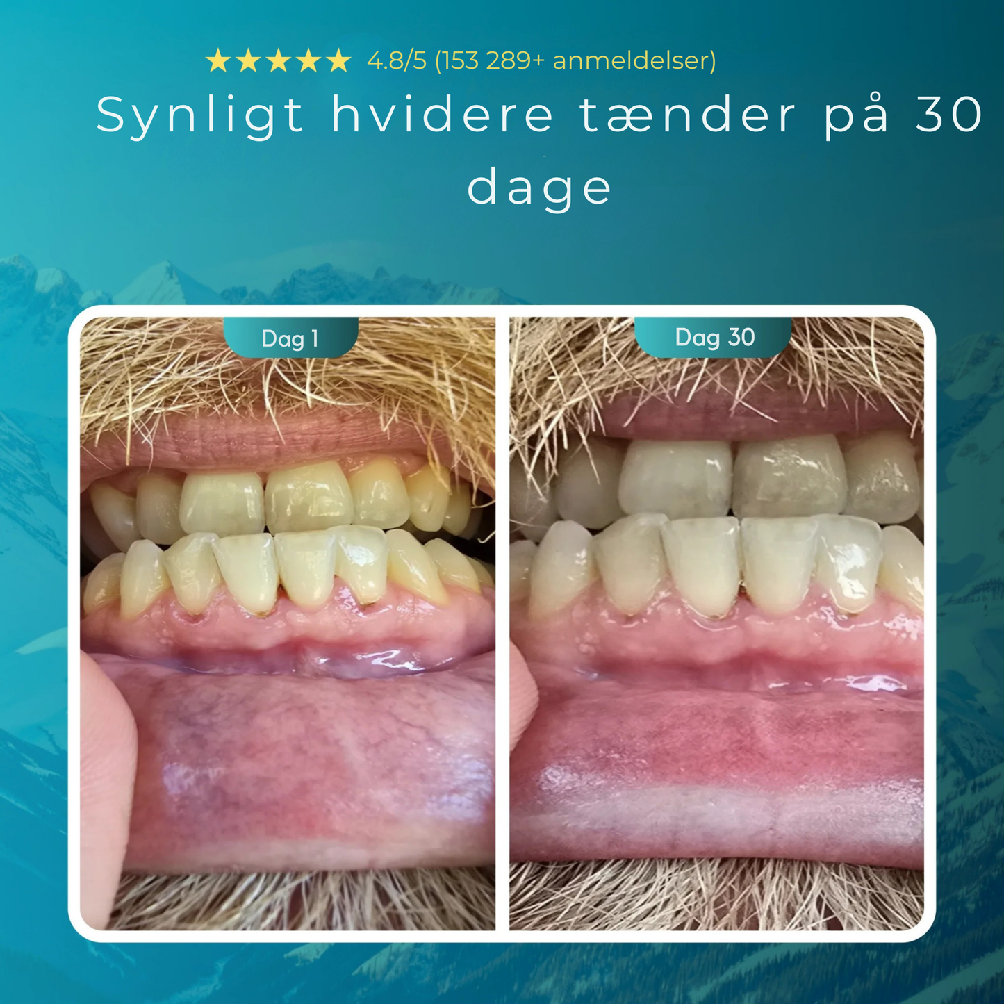 Mintara™ | Den Ultimative Tand-Opgradering