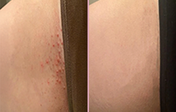 <h2><strong>Tro ikke bare på os, se hvad andre siger!</strong></h2>