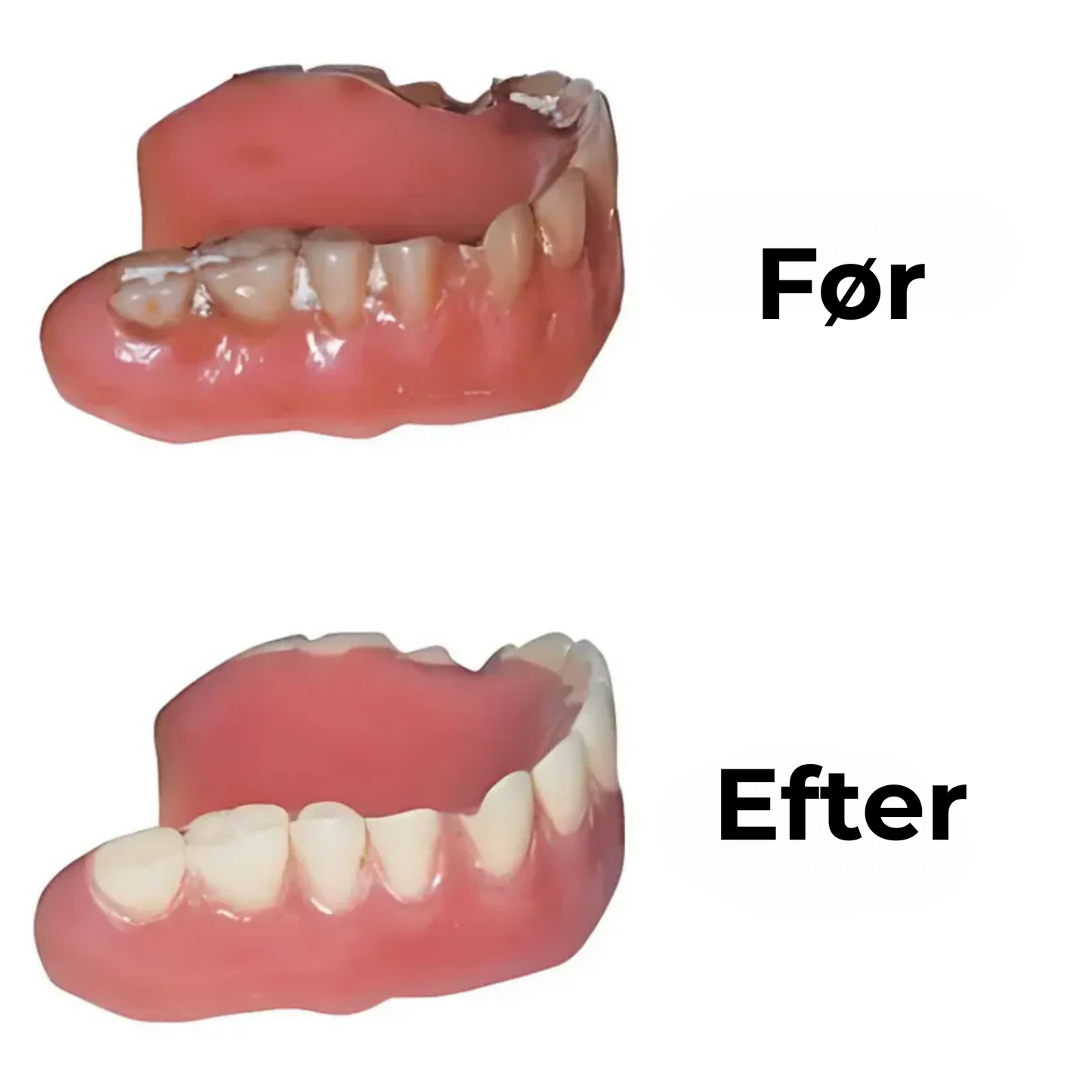 Denta Dome | Den ultimative dybderengøring, ud over børstning