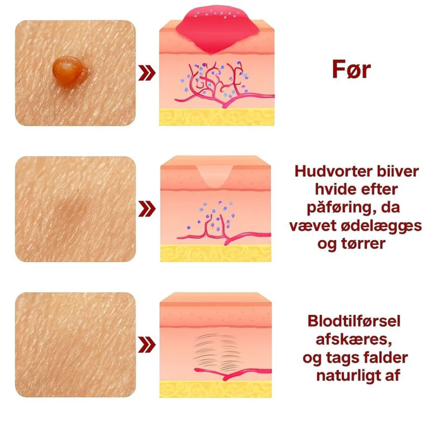 Dermapen™ | Smertefri, arfri og hurtig