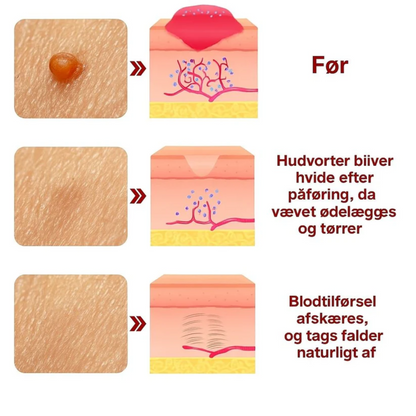 Dermapen™ | Smertefri, arfri og hurtig