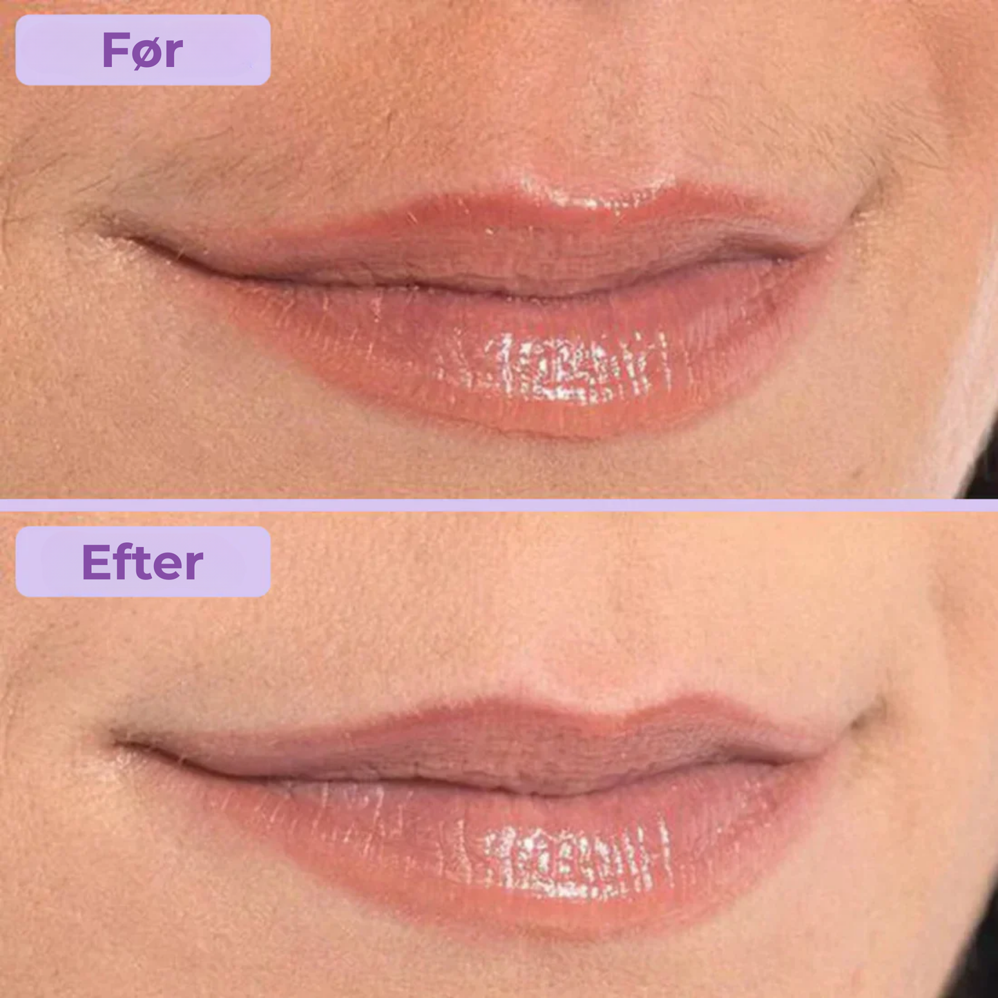 Silkea | Klar til en fejlfri, strålende ansigt