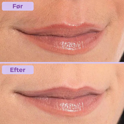 Silkea | Klar til en fejlfri, strålende ansigt