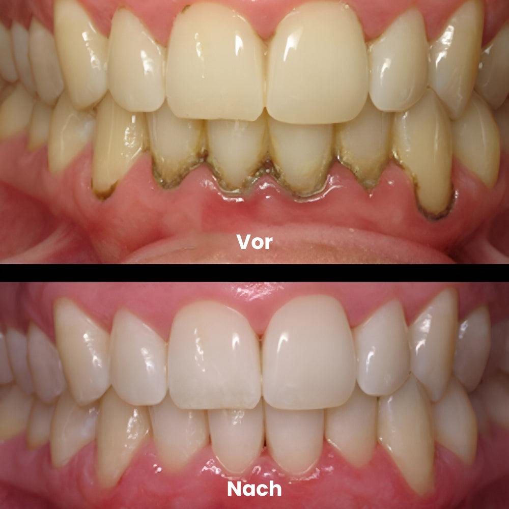 <h2><strong>Tro ikke bare på os, se hvad andre siger!</strong></h2>