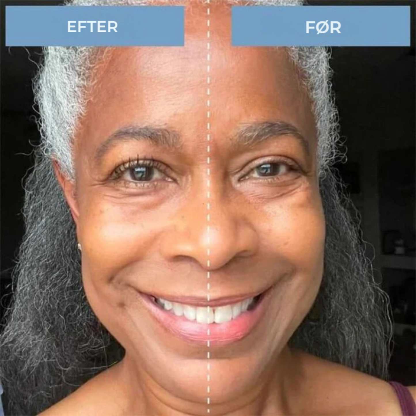 AuraLash™ | Helende Mascara til Dine Smukkeste, Modne Vipper