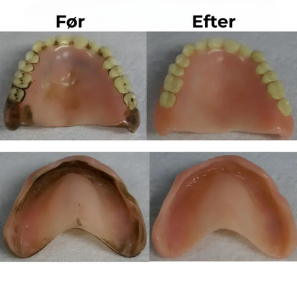 Denta Dome | Den ultimative dybderengøring, ud over børstning