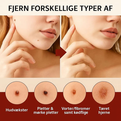 Dermapen™ | Smertefri, arfri og hurtig