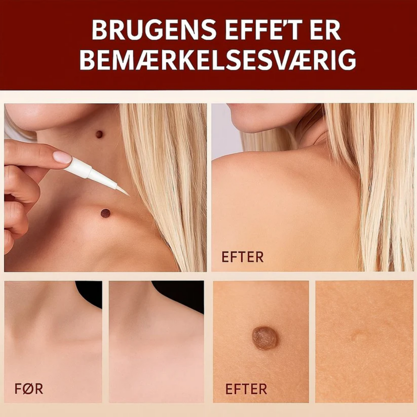 Dermapen™ | Smertefri, arfri og hurtig