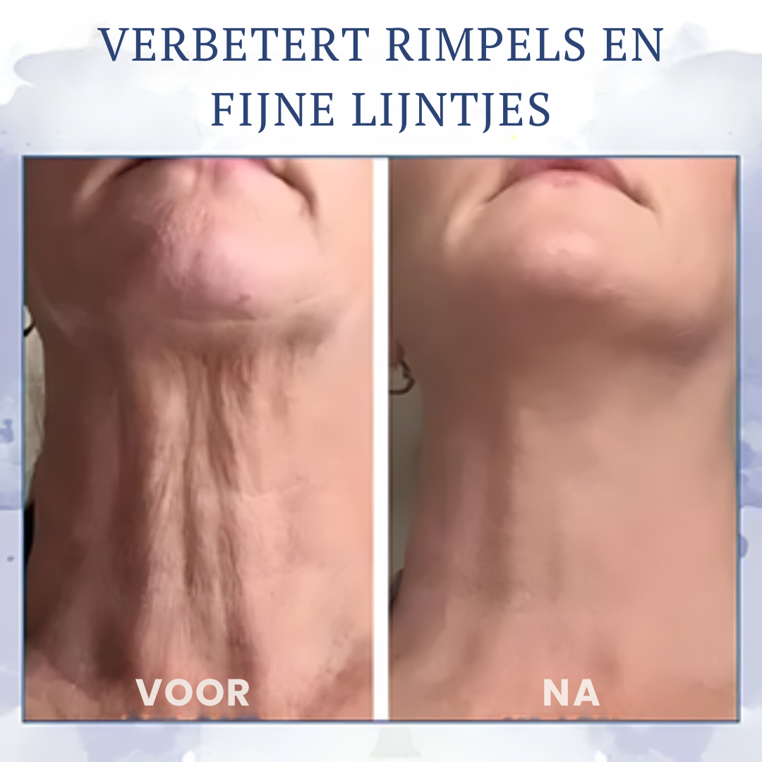 Firméa™ | Opstrammende og rynkereducerende creme