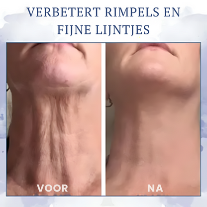 Firméa™ | Opstrammende og rynkereducerende creme