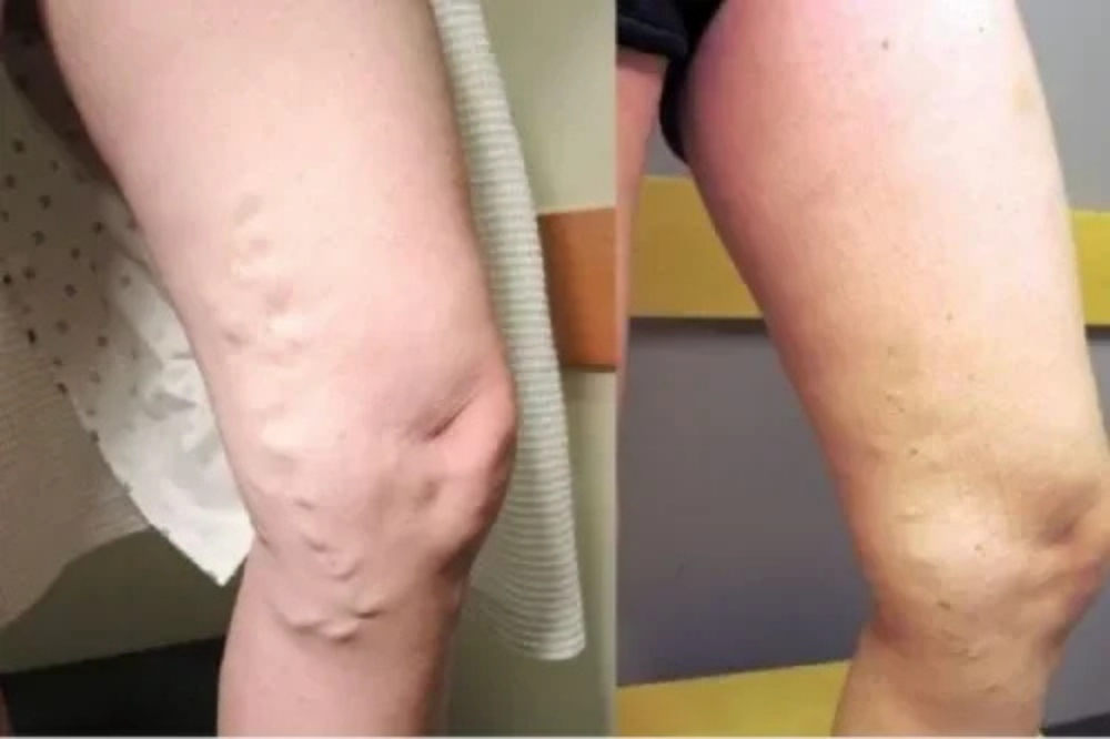 <p><strong>Over 60.000+ bekræftede kunder</strong></p>