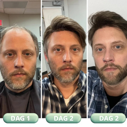 Evergrow™ Vegansk Hårolie | Aktiverer op til 91% hårvækst på 7 dage