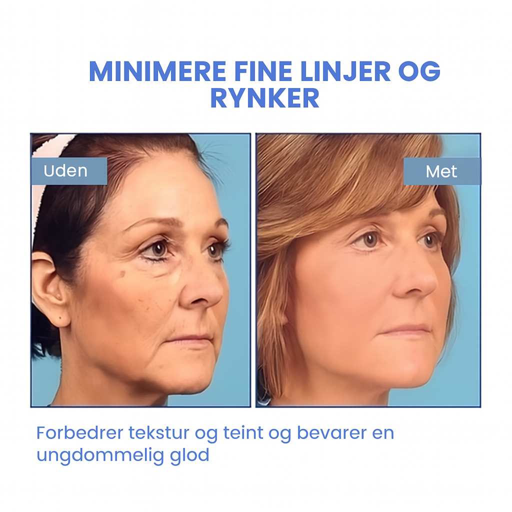 FirmSkin™ | Botox Ansigtsserum