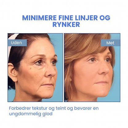 FirmSkin™ | Botox Ansigtsserum