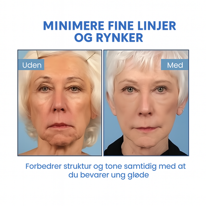 FirmSkin™ | Botox Ansigtsserum