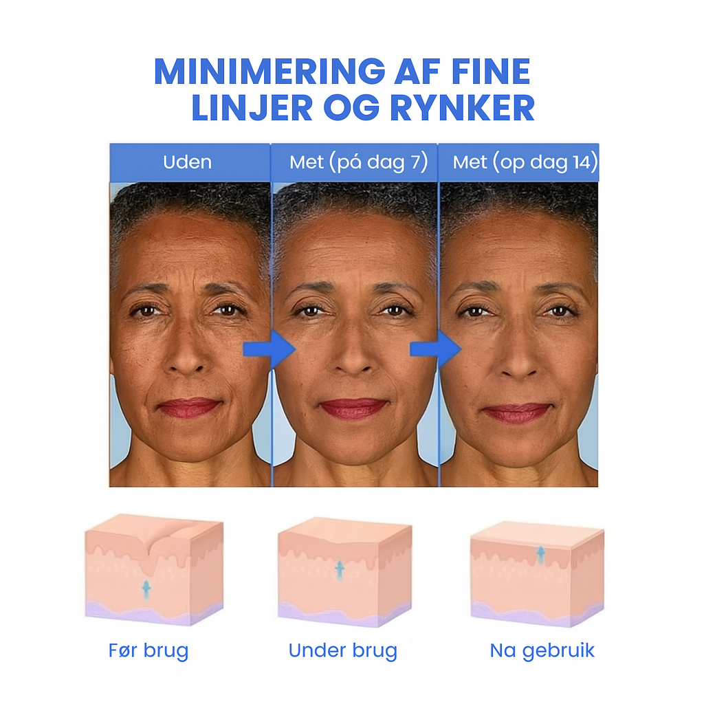 FirmSkin™ | Botox Ansigtsserum
