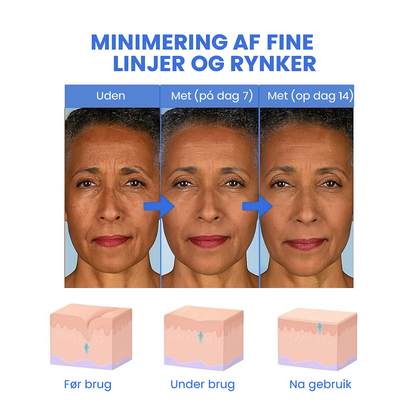 FirmSkin™ | Botox Ansigtsserum
