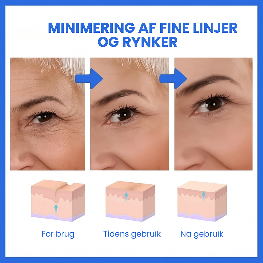 FirmSkin™ | Botox Ansigtsserum