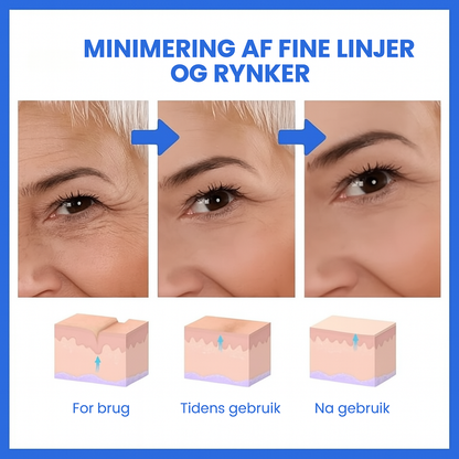 FirmSkin™ | Botox Ansigtsserum
