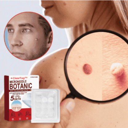 ClearTag™ | Hurtig og fejlfri hud på 5 dage