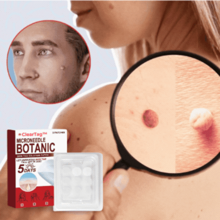 ClearTag™ | Hurtig og fejlfri hud på 5 dage