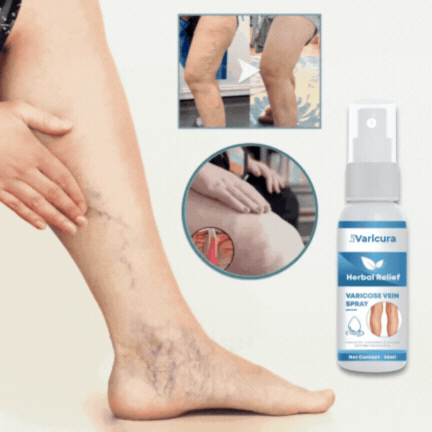 Varicura | Stop med at skjule dine ben, og vis din styrke