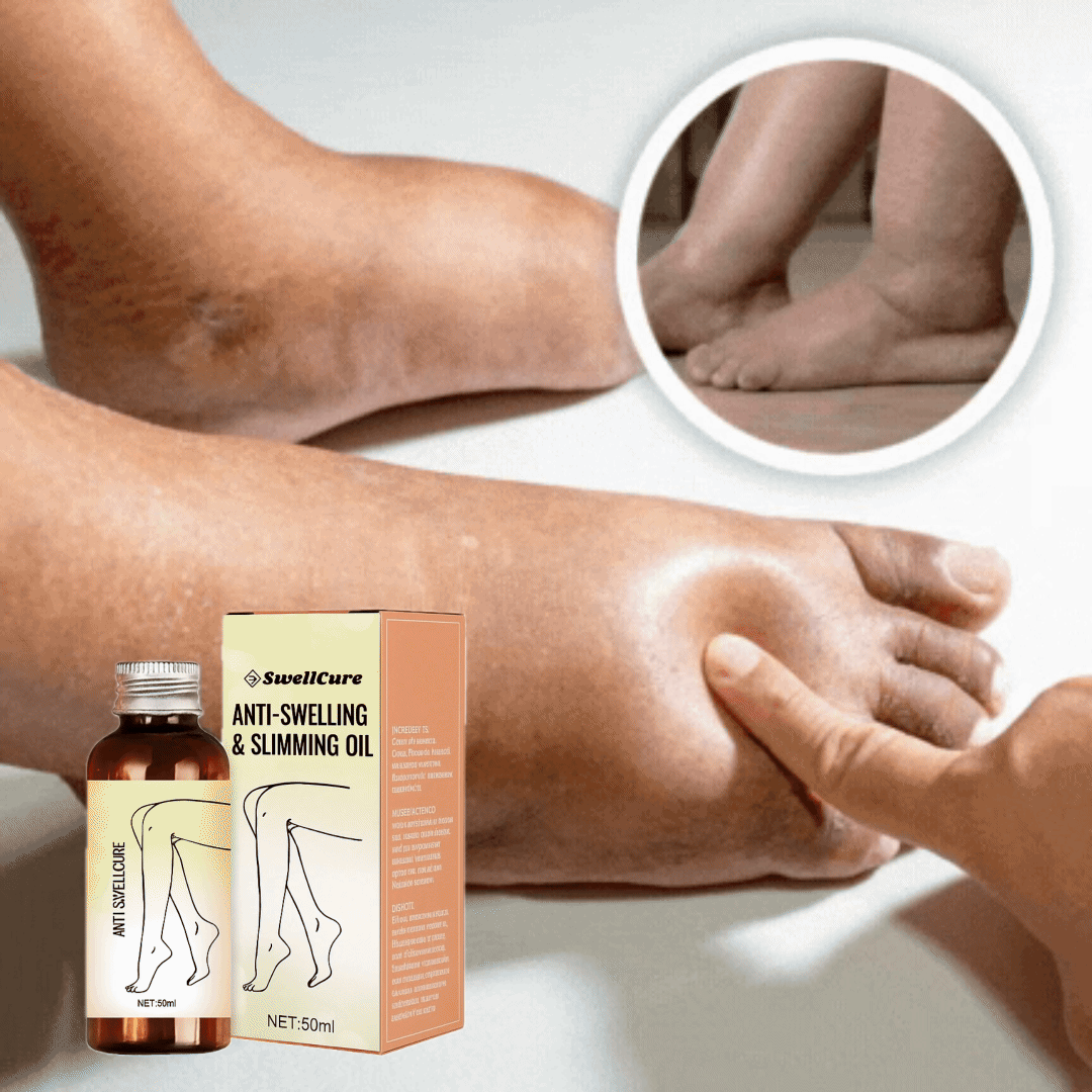 SwellGone™ - Reducerer benhævelse med 90% på kun 7 dage!
