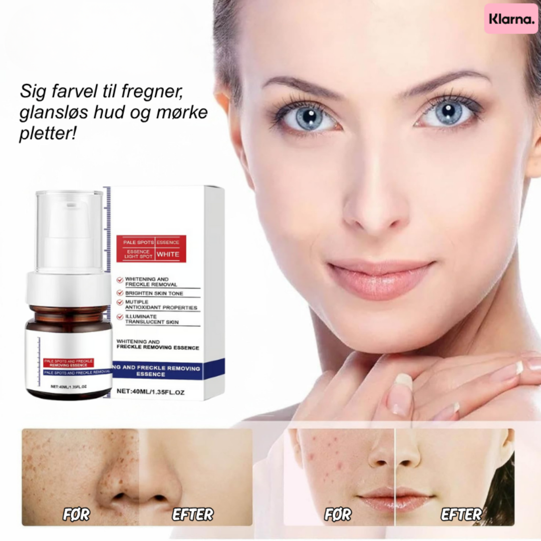 GlowPure™ | Sig farvel til fregner, glansløs hud og mørke pletter!