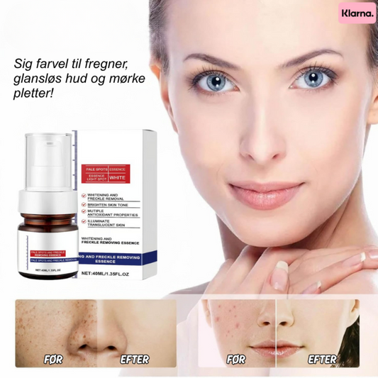 GlowPure™ | Sig farvel til fregner, glansløs hud og mørke pletter!