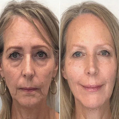 FirmSkin™ | Botox Ansigtsserum