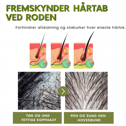 Evergrow™ Vegansk Hårolie | Aktiverer op til 91% hårvækst på 7 dage