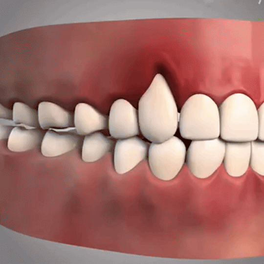 Gum Repair Gel revitaliserer tandkødet og lysner tænderne inden for den første uge.