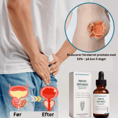 Prostacare™ | Minsker hævet prostata med 53% – på kun 5 dage