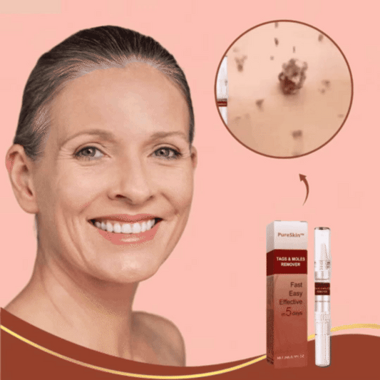 PureSkin™ | Fjerner vorter og alderspletter – smertefrit inden for 3 dage!