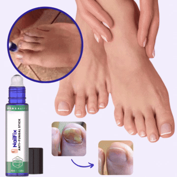 NailFix Stick | Eliminer neglesvamp på kun 5 dage!