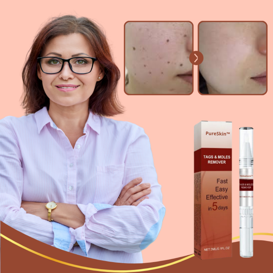 PureSkin™ | Fjerner vorter og alderspletter – smertefrit inden for 3 dage!