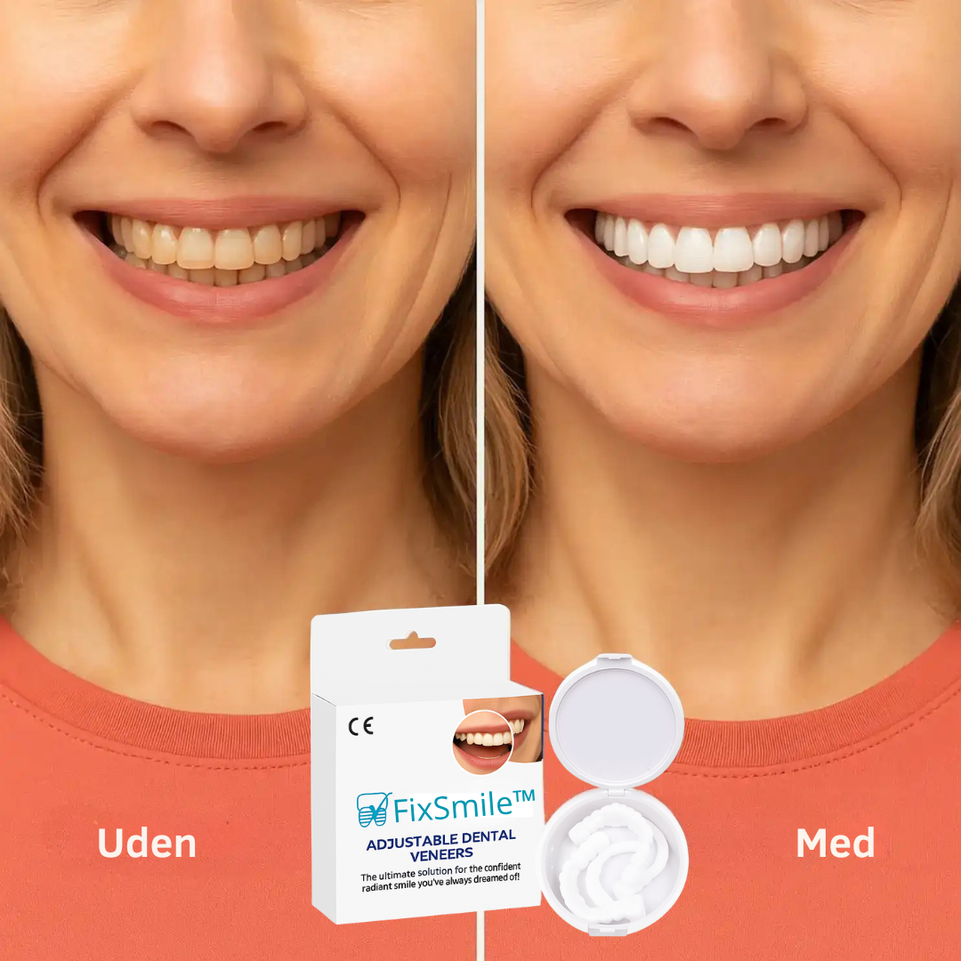 FixSmile™ Tandfacader | Smukke hvide tænder på kun 60 sekunder! (1+1 GRATIS)